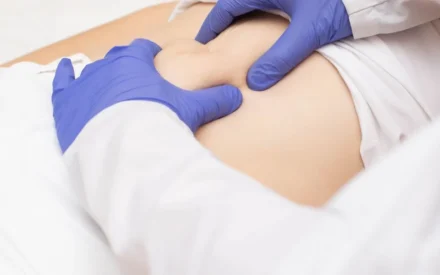 Κήλη: Ποια είναι τα Είδη και Πότε Απαιτείται Επέμβαση;